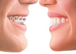 Orthodontic Dentistry Gurgaon